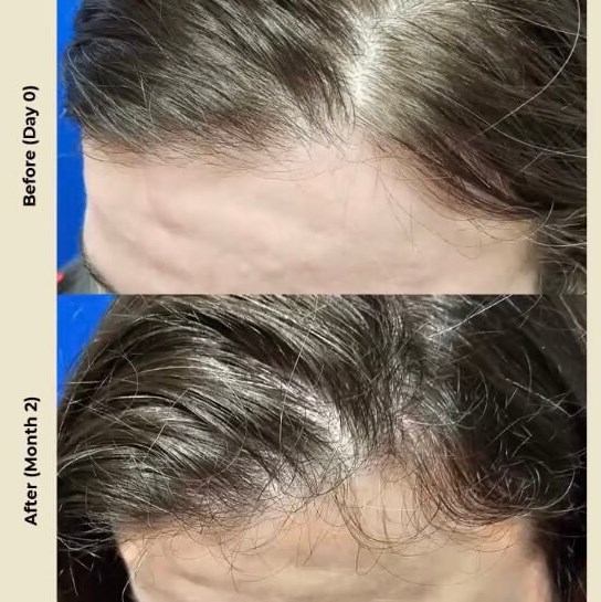 Hair3